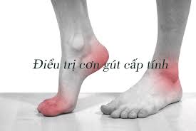 Gout cấp tính 