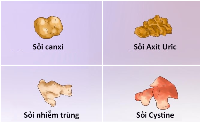 cac-loai-soi-than