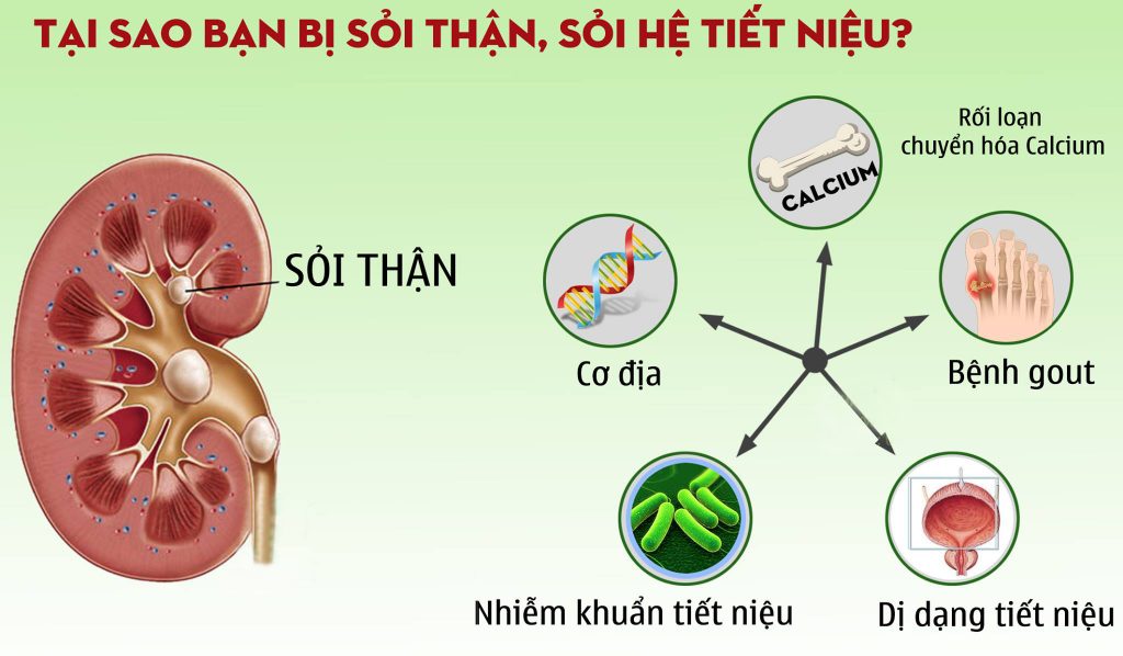 chua-soi-than-1